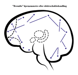 hvordan behandles depression. Lægevidenskaben forsøger at afhjælpe depressionen med kognitiv terapi, medicin eller i de grove tilfælde med elektrochok. Det kan have mange bivirkninger. Nyere forskningsresultater viser derimod, at opmærksomhedstræning har en revolutionerende effekt hvordan behandles depression. Lægevidenskaben forsøger at afhjælpe depressionen med kognitiv terapi, medicin eller i de grove tilfælde med elektrochok. Det kan have mange bivirkninger. Nyere forskningsresultater viser derimod, at opmærksomhedstræning har en revolutionerende effekt