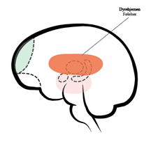 Dyrehjernen i den tredelte hjerne. Kaldes også det limbiske system, og har til opgave at skelne mellem, hvad der føles godt og lystfyldt, og hvad der føles skidt og bør undgås. Det er følelsernes hjemsted. Det belønner adfærd, som er skabt til at maksimere overlevelse, og holder organismen væk fra situationer, som er truende eller ubehagelige